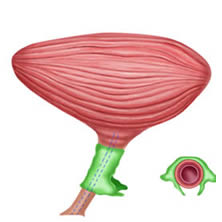 fig4